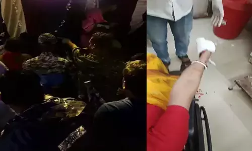 CG News : रथ के पहिए के नीचे आने से बुजुर्ग महिला की हथेली में फ्रैक्चर, श्रद्धालुओं की सूझबूझ से टला बड़ा हादसा