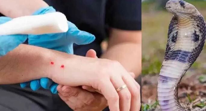snake bite: हॉस्टल में आधी रात घुसा जहरीला नाग, सो रहीं 6 छात्राओं को डसा, 3 की इलाज के दौरान मौत