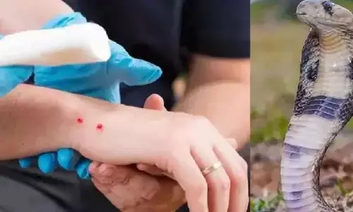 snake bite: हॉस्टल में आधी रात घुसा जहरीला नाग, सो रहीं 6 छात्राओं को डसा, 3 की इलाज के दौरान मौत