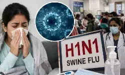 h1n1 virus delhi: दिल्ली-NCR में में एक साल में छह गुना बढ़ा H1N1 का प्रकोप, फ्लू जैसे इन लक्षणों को न करें नजरअंदाज h1n1 virus delhi: दिल्ली-NCR में में एक साल में छह गुना बढ़ा H1N1 का प्रकोप, फ्लू जैसे इन लक्षणों को न करें नजरअंदाज