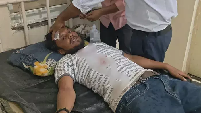 MP Crime : मटर बेचकर लौट रहे गल्ला व्यापारी से 1.70 लाख की लूट, नकाबपोश बदमाशों ने कट्टे की बट से किया हमला
