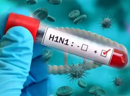 Swine Flu H1N1 in Durg Bhilai: दुर्ग-भिलाई में स्वाइन फ्लू के दो नए मरीज, जानिए H1N1 के लक्षण और बचाव के उपाय Swine Flu H1N1 in Durg Bhilai: दुर्ग-भिलाई में स्वाइन फ्लू के दो नए मरीज, जानिए H1N1 के लक्षण और बचाव के उपाय