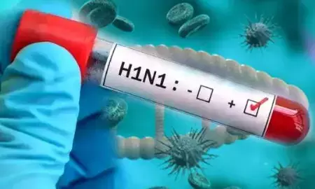 Swine Flu H1N1 in Durg Bhilai: दुर्ग-भिलाई में स्वाइन फ्लू के दो नए मरीज, जानिए H1N1 के लक्षण और बचाव के उपाय