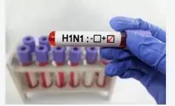 Ambikapur News: जेल अधिकारी H1N1 से संक्रमित, इलाज के लिए रायपुर रेफर, स्वास्थ्य विभाग अलर्ट