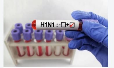Ambikapur News: जेल अधिकारी H1N1 से संक्रमित, इलाज के लिए रायपुर रेफर, स्वास्थ्य विभाग अलर्ट