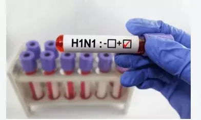 Ambikapur News: जेल अधिकारी H1N1 से संक्रमित, इलाज के लिए रायपुर रेफर, स्वास्थ्य विभाग अलर्ट