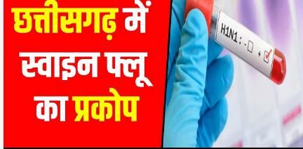 Chhattisgarh Swine Flu: छत्तीसगढ़ में बढ़ रहा H1N1 का संक्रमण, 10 नए मरीज मिले; रायपुर में एक्टिव केस बढ़कर 9