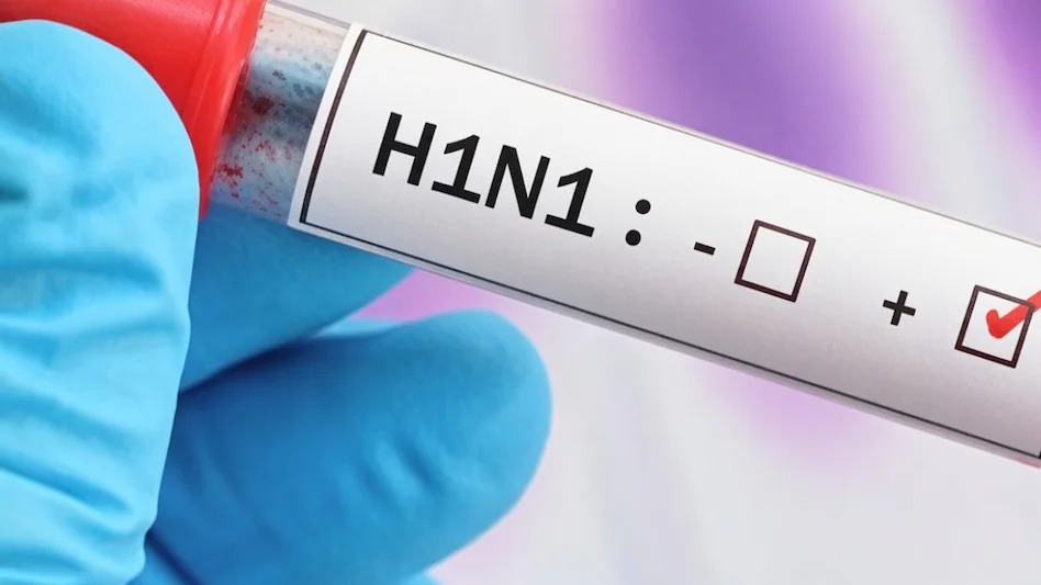 Swine Flu : H1N1 ने बढ़ाई चिंता, 36 मरीज मिले, आधे से ज्यादा बच्चे-किशोर