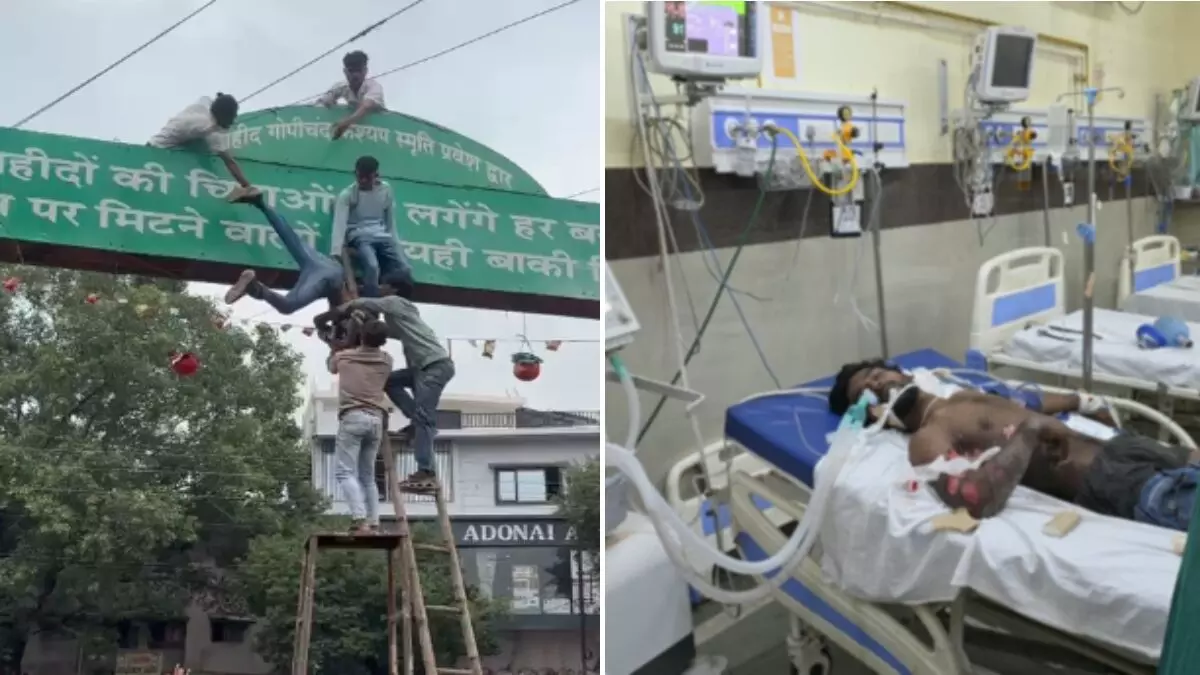 37845-electric-shock CG News : जन्माष्टमी पर मटकी बांधना पड़ा भारी, हाईटेंशन तार से झुलसा युवक