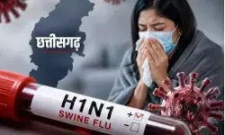 Chhattisgarh Swine Flu: प्रदेश में में 205 पहुंचा H1N1 का आंकड़ा, रायपुर में सबसे ज्यादा 89 केस