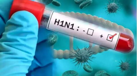 Chhattisgarh Swine Flu Alert: छत्तीसगढ़ में स्वाइन फ्लू ने बढ़ाई चिंता, 122 एक्टिव मरीज; संक्रमितों की संख्या 344 के पार