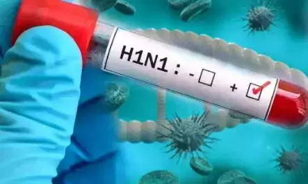 Chhattisgarh Swine Flu Alert: छत्तीसगढ़ में स्वाइन फ्लू ने बढ़ाई चिंता, 122 एक्टिव मरीज; संक्रमितों की संख्या 344 के पार