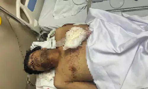MP News : युवक ने खुद को गोली मारकर की आत्महत्या, पुलिस जांच में जुटी