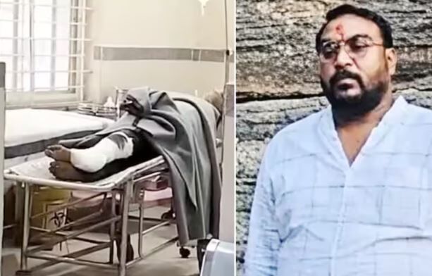 Sagar-Banda poisonous Liquor case: सागर जहरीली शराब कांड का मुख्य आरोपी रवि लखेरा का शार्ट एनकाउंटर, अस्पताल में भर्ती