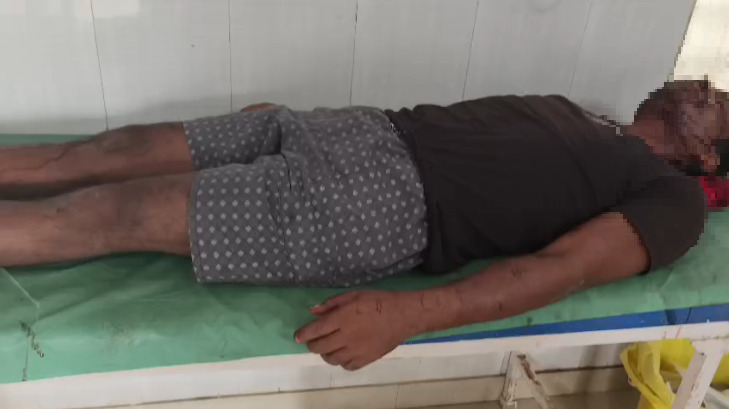 CG News : बकरी चराने गए ग्रामीण पर भालू ने किया हमला, गंभीर हालत में अंबिकापुर रेफर