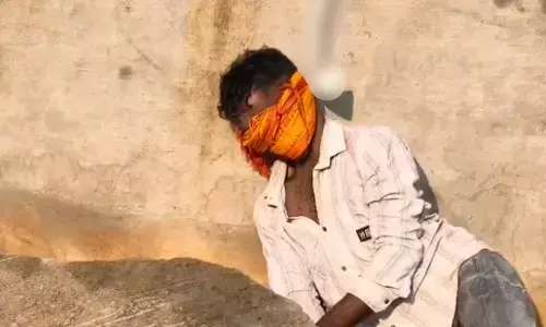 Raipur City News : पंडरी में होर्डिंग पोल से लटका मिला युवक का शव, सिर पर चोट के निशान से बढ़ा संदेह
