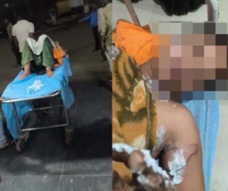 MP News : पति ने पत्नी पर पेट्रोल डालकर लगाया आग, गंभीर हालत में अस्पताल में भर्ती, जानें क्या है वजह
