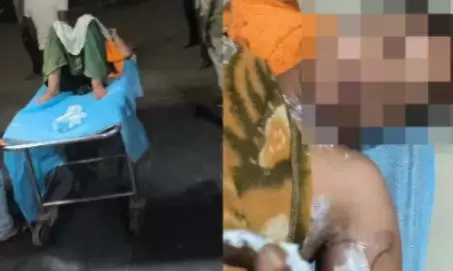 MP News : पति ने पत्नी पर पेट्रोल डालकर लगाया आग, गंभीर हालत में अस्पताल में भर्ती, जानें क्या है वजह